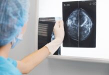 Esta iniciativa ha reducido exitosamente el “tiempo de diagnóstico” del cáncer de mama en Colombia Esta iniciativa ha reducido exitosamente el "tiempo de diagnóstico" del cáncer de mama en Colombia